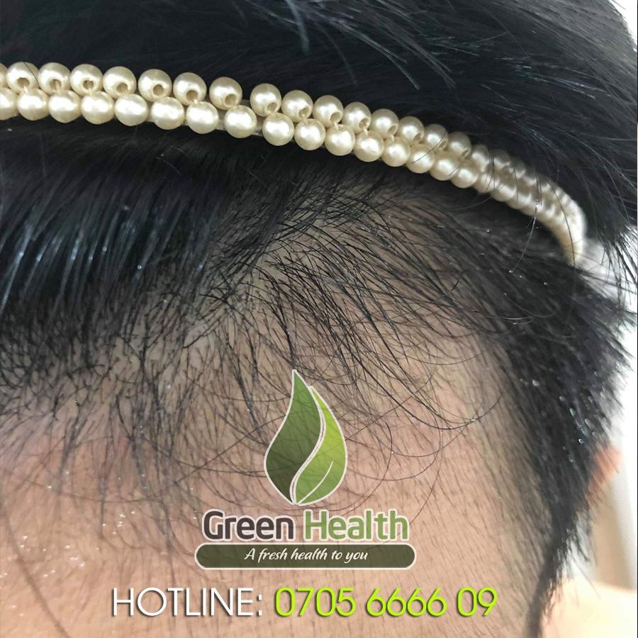 https://vn-live-01.slatic.net/p/50b9e6cc146a116413247489dff2ccff.jpg