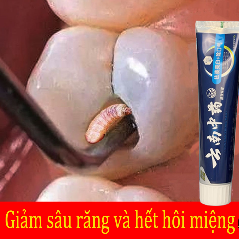 Kem đánh răng làm trắng răng Ngăn ngừa hôi miệng Kem đánh răng 180g Giảm sâu răng Chảy máu Kẹo cao su Loại bỏ cao răng Hôi miệng Làm trắng răng Làm trắng răng Trung Quốc Dược thảo Unisex
