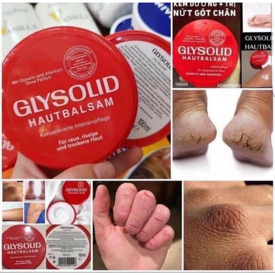 Kem dưỡng + trrị nứt nẻ tay chân, á sừng Glysolid 100ml