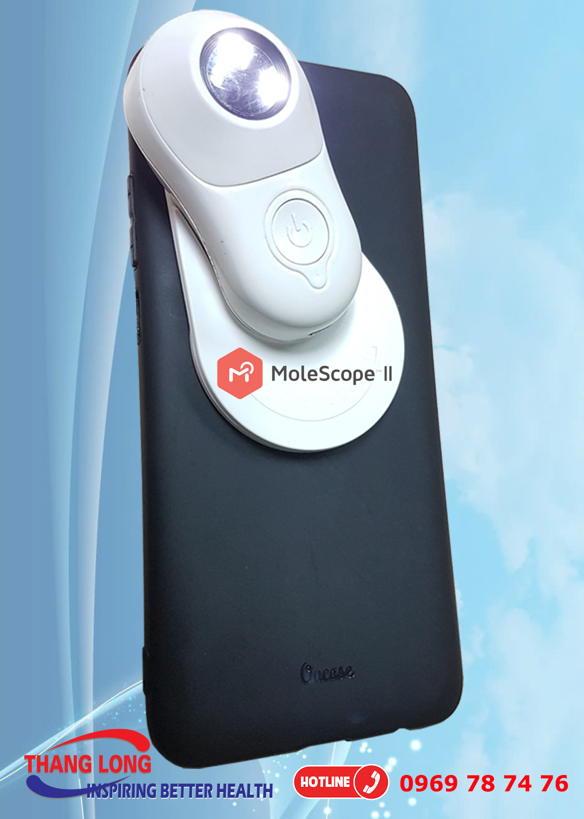 Dermoscopy - Thiết bị soi da tích hợp điện thoại và máy tính bảng