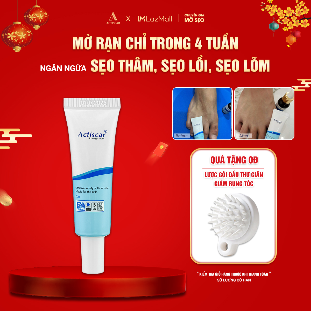 Kem mờ sẹo actiscar giúp làm mờ sẹo do sẹo thâm /mụn/ rỗ / lõm 20g