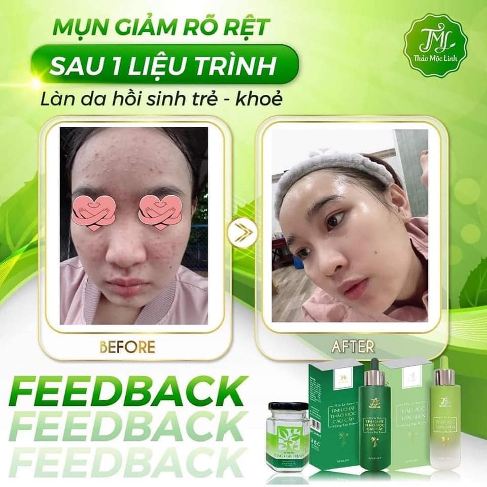 Bộ 1 Đông Y Thảo Mộc Linh và1 Bột rửa mặt Thảo Mộc Thiên Nhiên