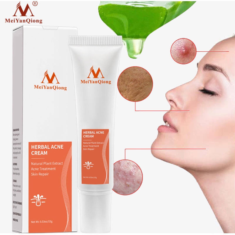 【CW】 Acne Removal Herbal Anti-acne Repair Fade Spots Oil Control Whitening Moisturizing Gel 15g