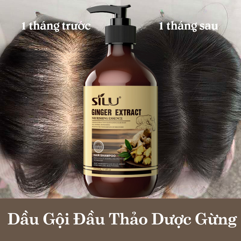 Cặp Dầu Gội Xả Dưỡng Sinh Gừng Tươi SILU Thảo Mộc Khắc Tinh Của Rụng Tóc, Loại Bỏ Bết Tóc, Ngăn Ngừa Rụng Tóc, Kích Thích Mọc Tóc Bồng Bềnh, Làm Sạch Sâu Da Đầu, Loại Bỏ Dầu Nhờn Và Bụi Bẩn, Nuôi Dưỡng Tóc Dày Hơn