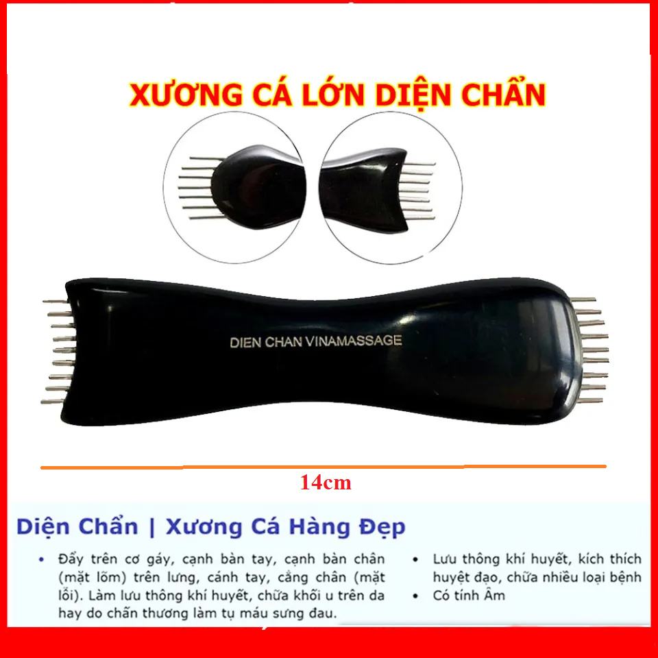 Diện chẩn xương cá