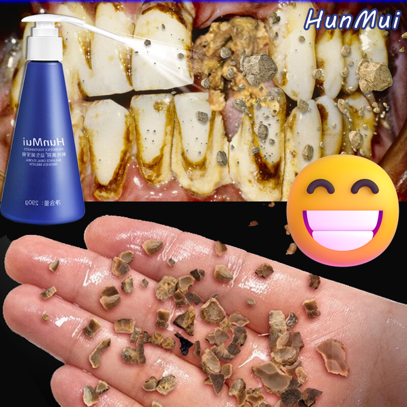 Kem đánh răng hunmui chính hãng 290G Kem đánh răng trắng răng Vệ Sinh Răng Miệng Không Hôi Miệng làm mềm cao răng xóa vàng làm trắng