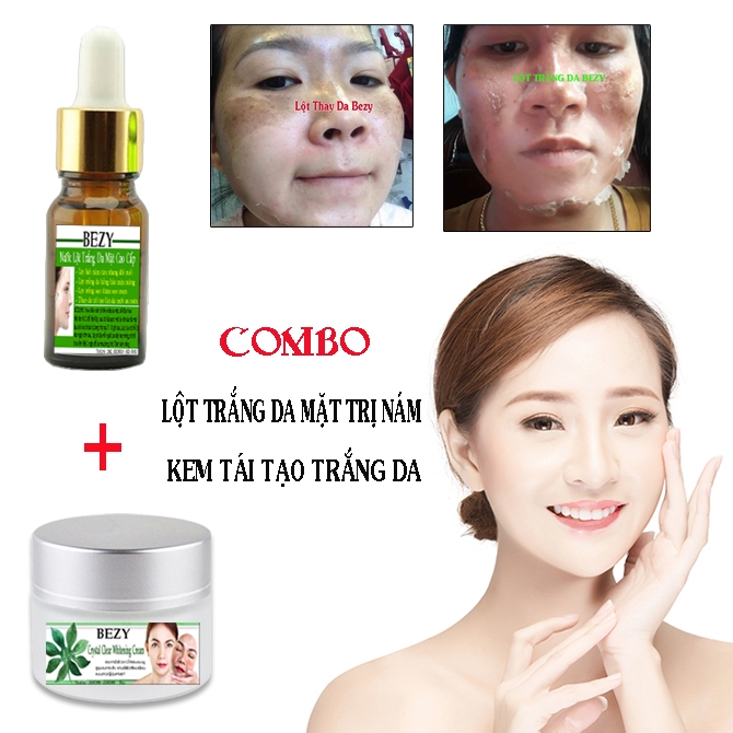 [HCM]Bộ Peel Trắng Da Mặt Tái Tạo Da