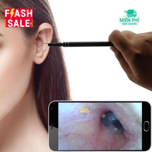 Dụng cụ lấy ráy tai tích hợp camera mini