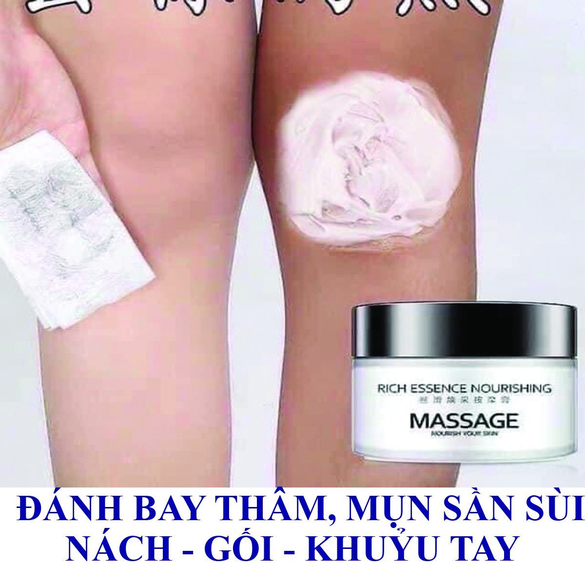 Kem bôi thâm Nách, đầu gối, khuỷu tay, mụn sần sùi