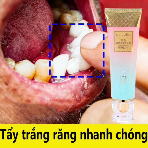 Kem đánh răng làm trắng Niacinamide whitening toothpaste 100g Loại bỏ sâu răng và mảng bám, phục hồi răng sâu và làm sạch răng
