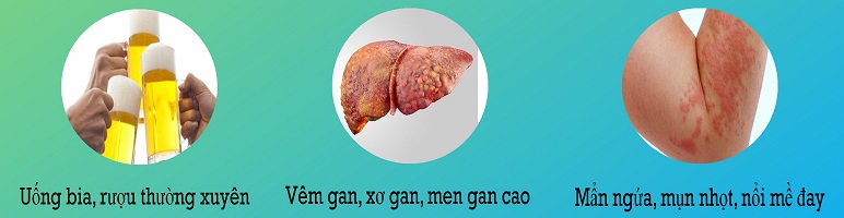 Viên Bổ Gan Sologan New (Hộp 60 Viên) - Sản phẩm của người Việt - cho người Việt. Hỗ trợ giải độc gan - Tăng cường chức năng gan 2