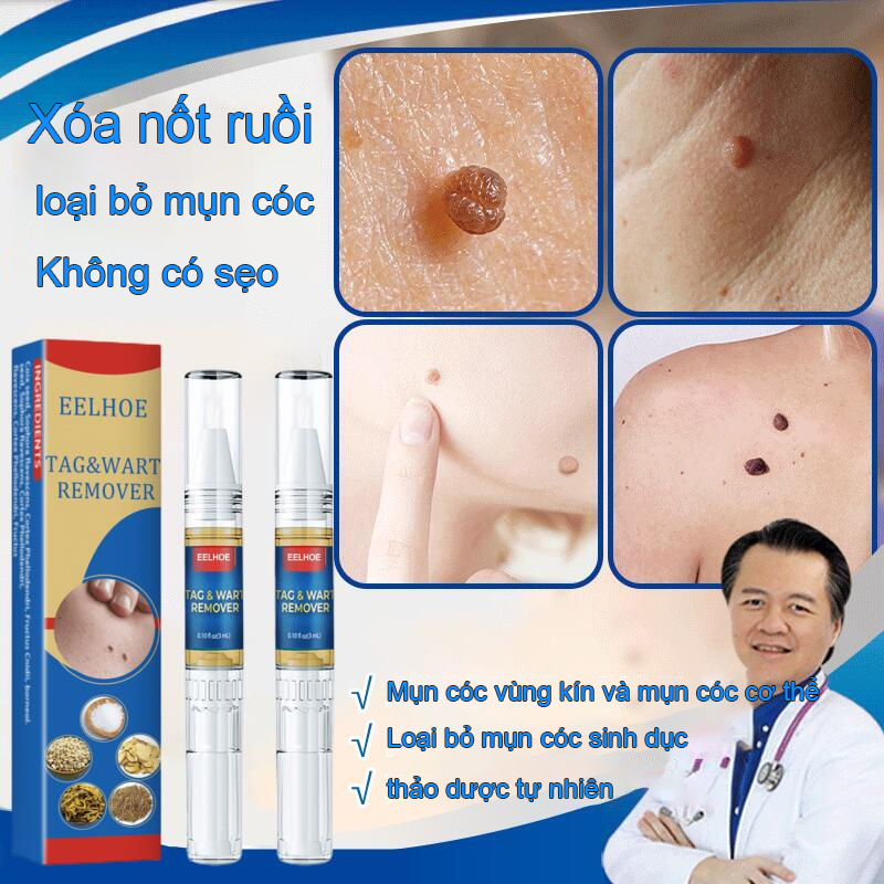 Tẩy nốt ruồi loại bỏ nốt ruồi mụn cóc chất tẩy cholesterol bút nước tẩy mụn cóc mụn thịt nhỏ tẩy không đau mà không
