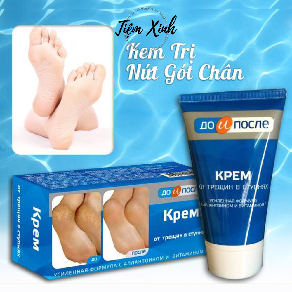 Kem trị nứt gót chân Kpem Apteka của Nga 50ml kem dưỡng da chân, nẻ gót chân mềm mịn