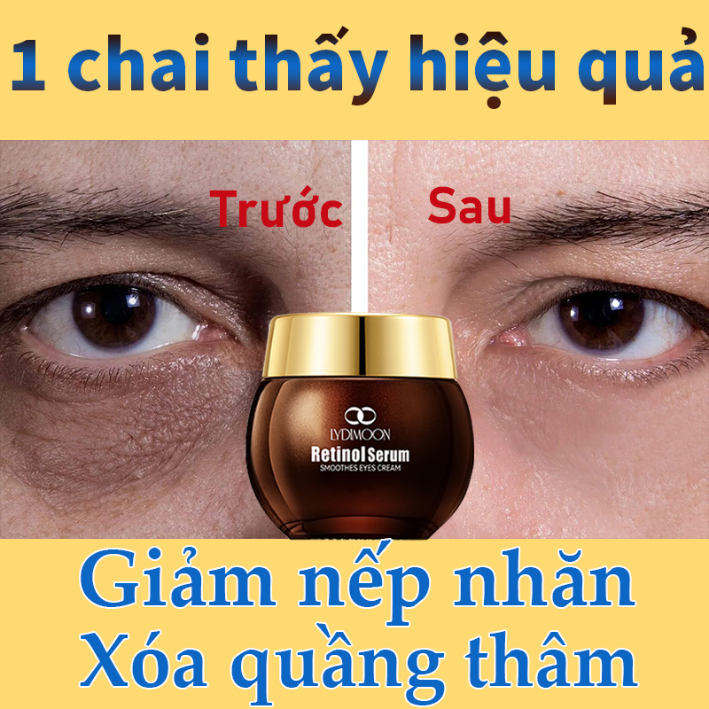 Kem Dưỡng Mắt Retinol 35g, xóa quầng thâm, giảm bọng mắt, giảm nếp nhăn, làm săn chắc da quanh mắt, chống lão hóa, phù hợp với mọi loại da