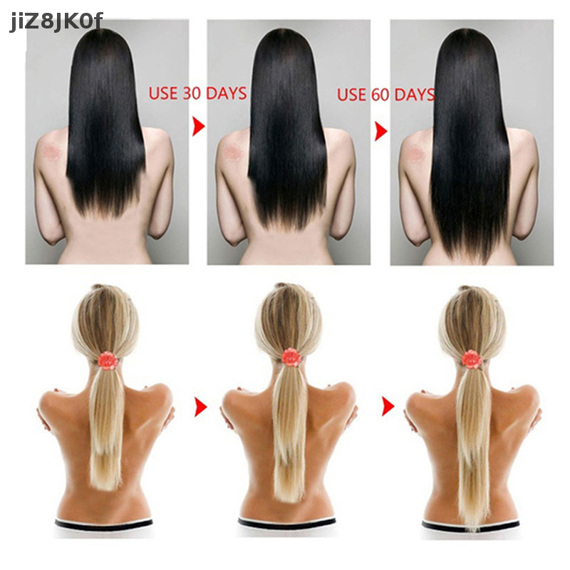jiZ8JK0f Gạo tăng trưởng tóc dầu gội chống rụng tóc Điều trị huyết thanh