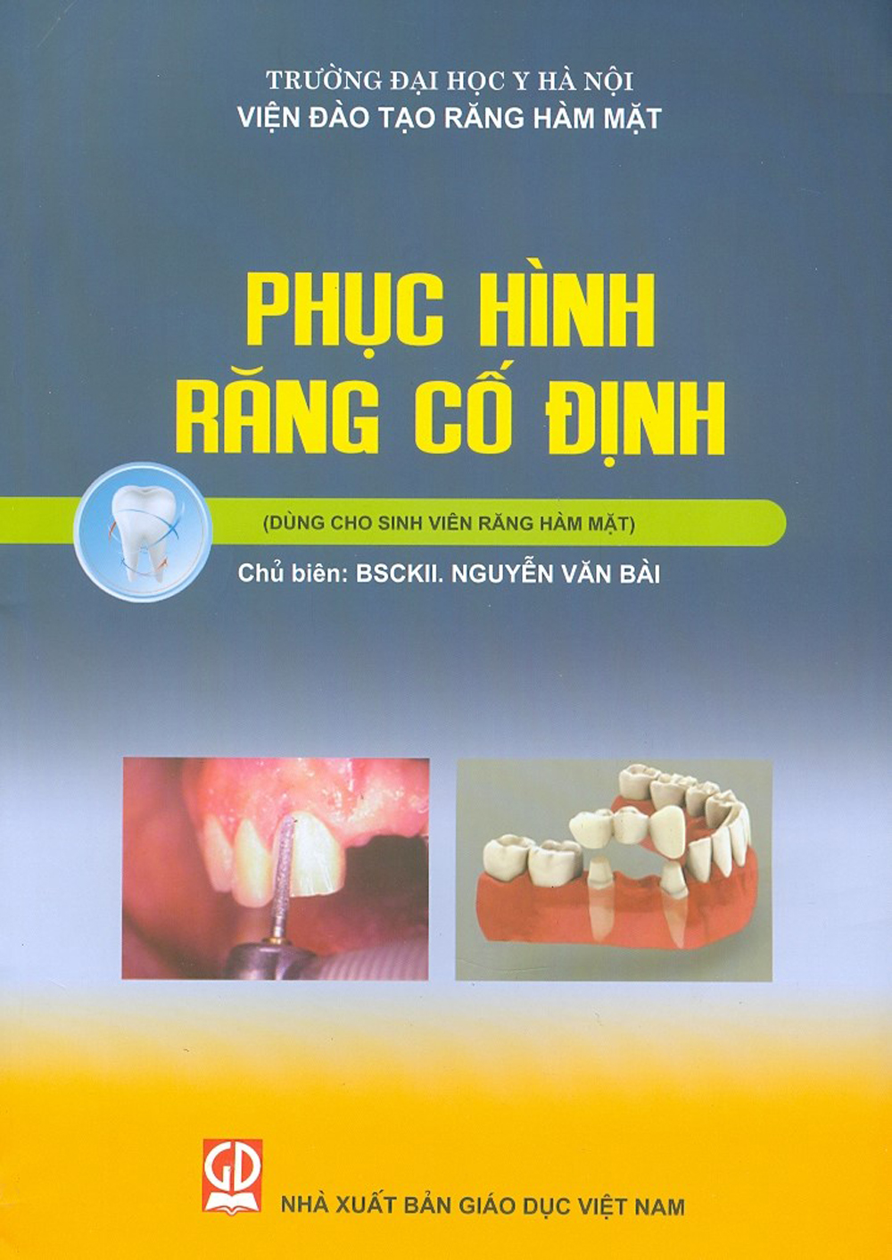 Phục hình răng cố định