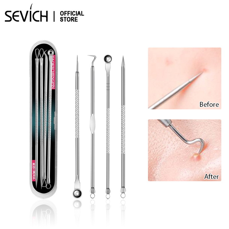 SEVICH Bộ Dụng Cụ Nặn Mụn 5 Cây Chuyên Nghiệp