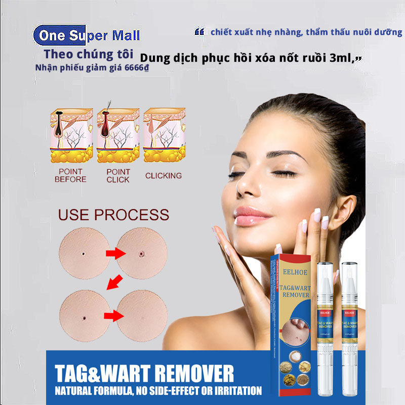 Tag&wart remover tẩy nốt ruồi xóa mụn ruồi trên mặt tàn nhang mụn cóc mụn thịt mụn cơm mắt cá tại nhà an toàn và gel mờ sẹo kem ngăn sẹo kem ngừa sẹo lồi thâm sẹo rỗ lâu năm các loại sẹo mụn.trâu remove every warts /bút xóa mụn cóc 3ml