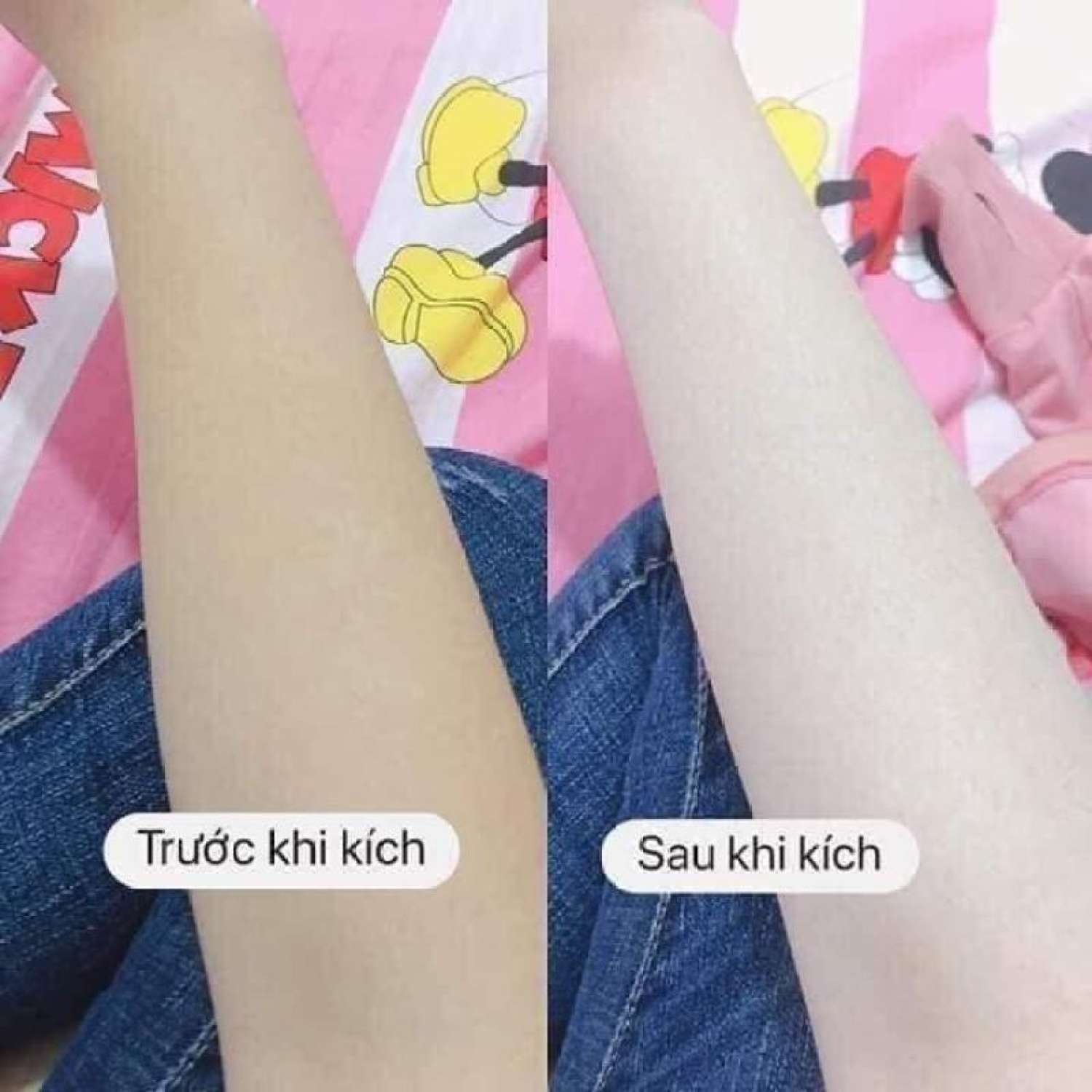 Kích trắng Vitamin B10 - kem dưỡng body