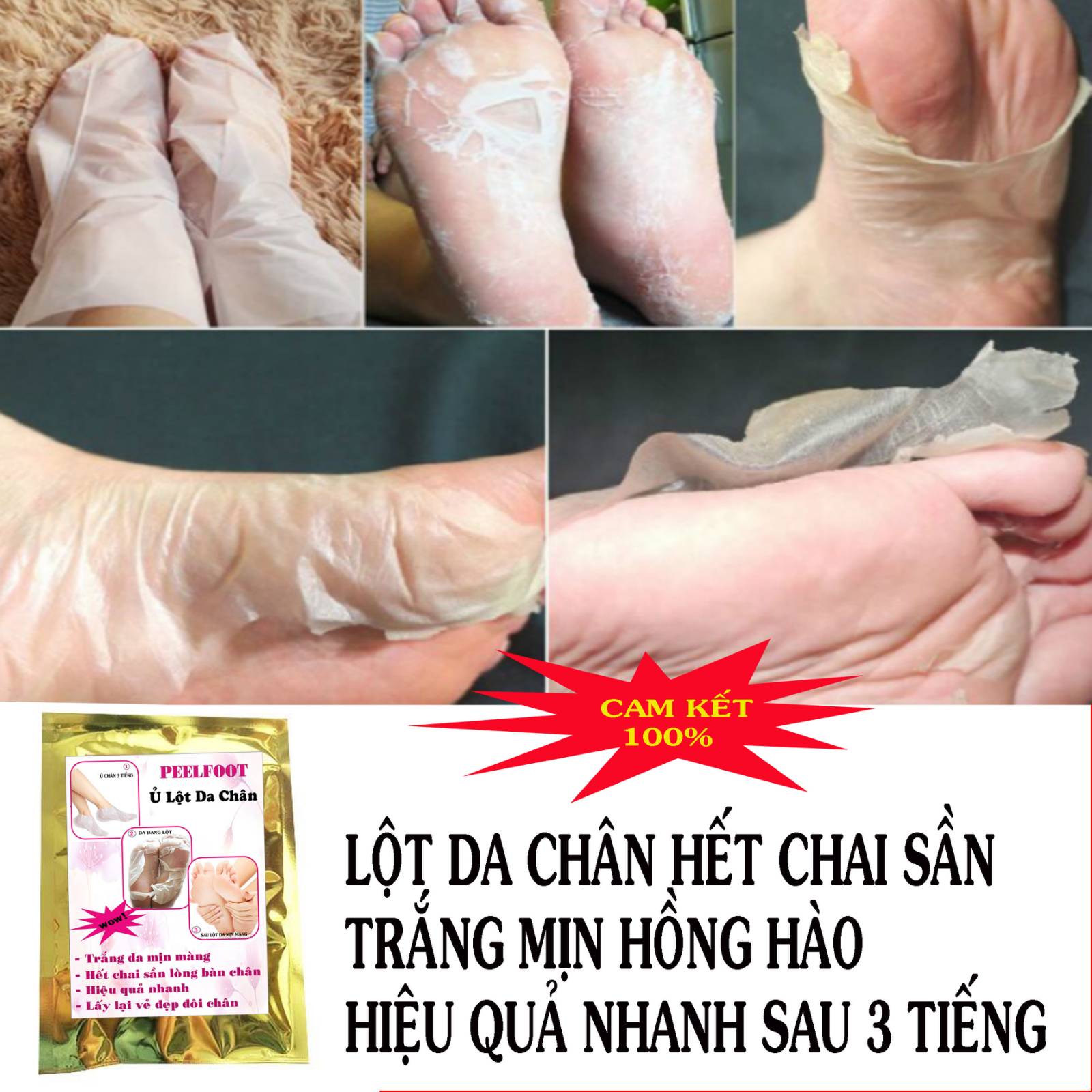 [HCM]Feelfoot Ủ Lột Da Chân Trắng Da Hết Chai Sần