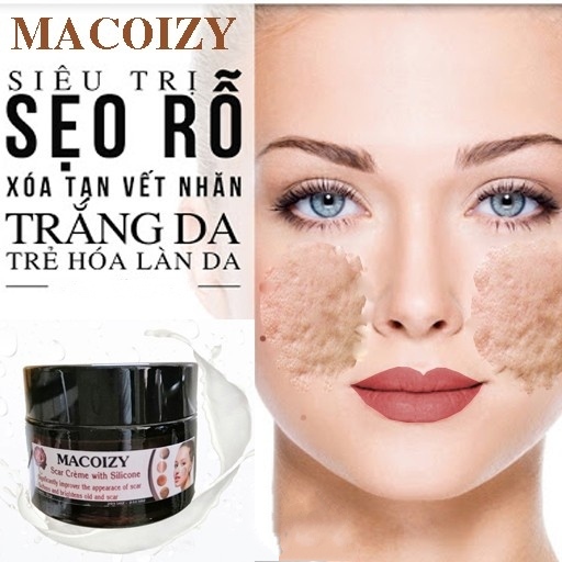 [HCM]KEM MACOIZY  SẸO RỖ SẸO MỤN SẸO THÂM