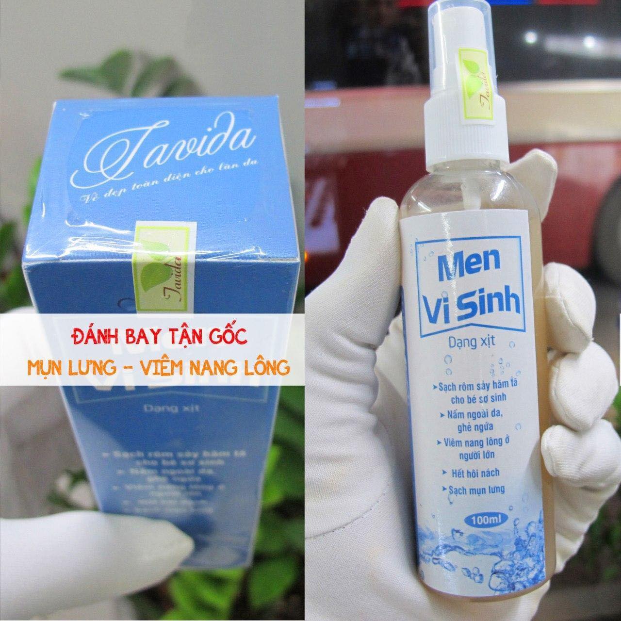 Mụn lưng mụn ngực men vi sinh tavida