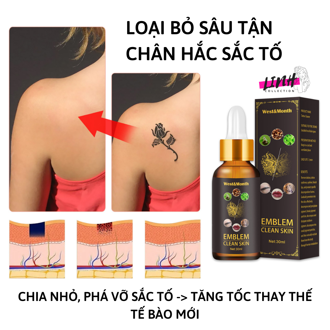 Xóa hình xăm 1 lần có hết không? Giải đáp từ chuyên gia