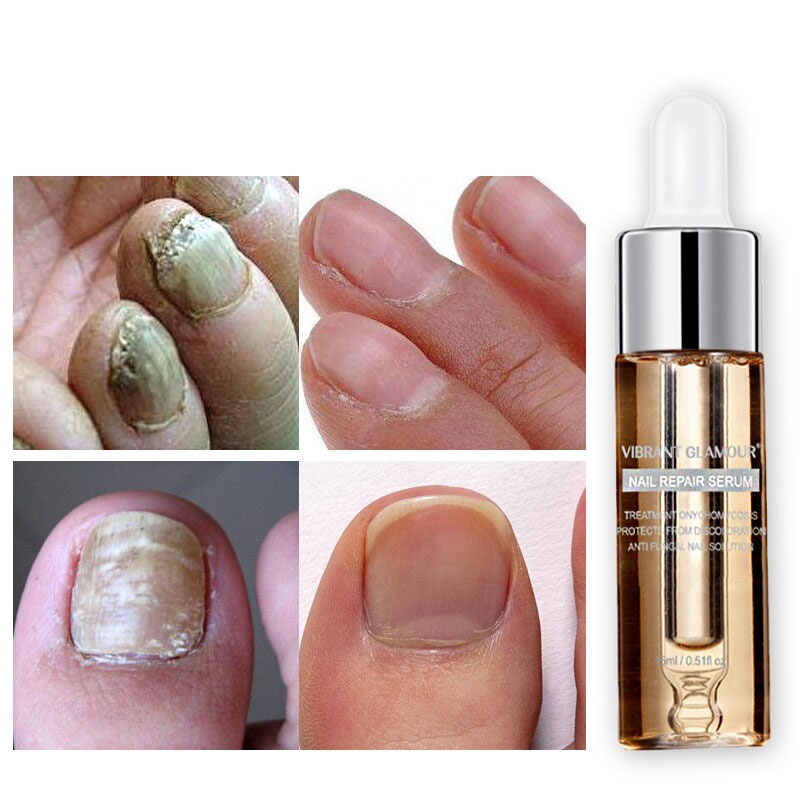 Vibrant Glamour Serum Dưỡng Móng Viền Móng Săn Chắc Khỏe