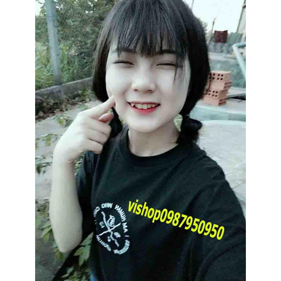 Răng nanh răng khểnh giả sứ