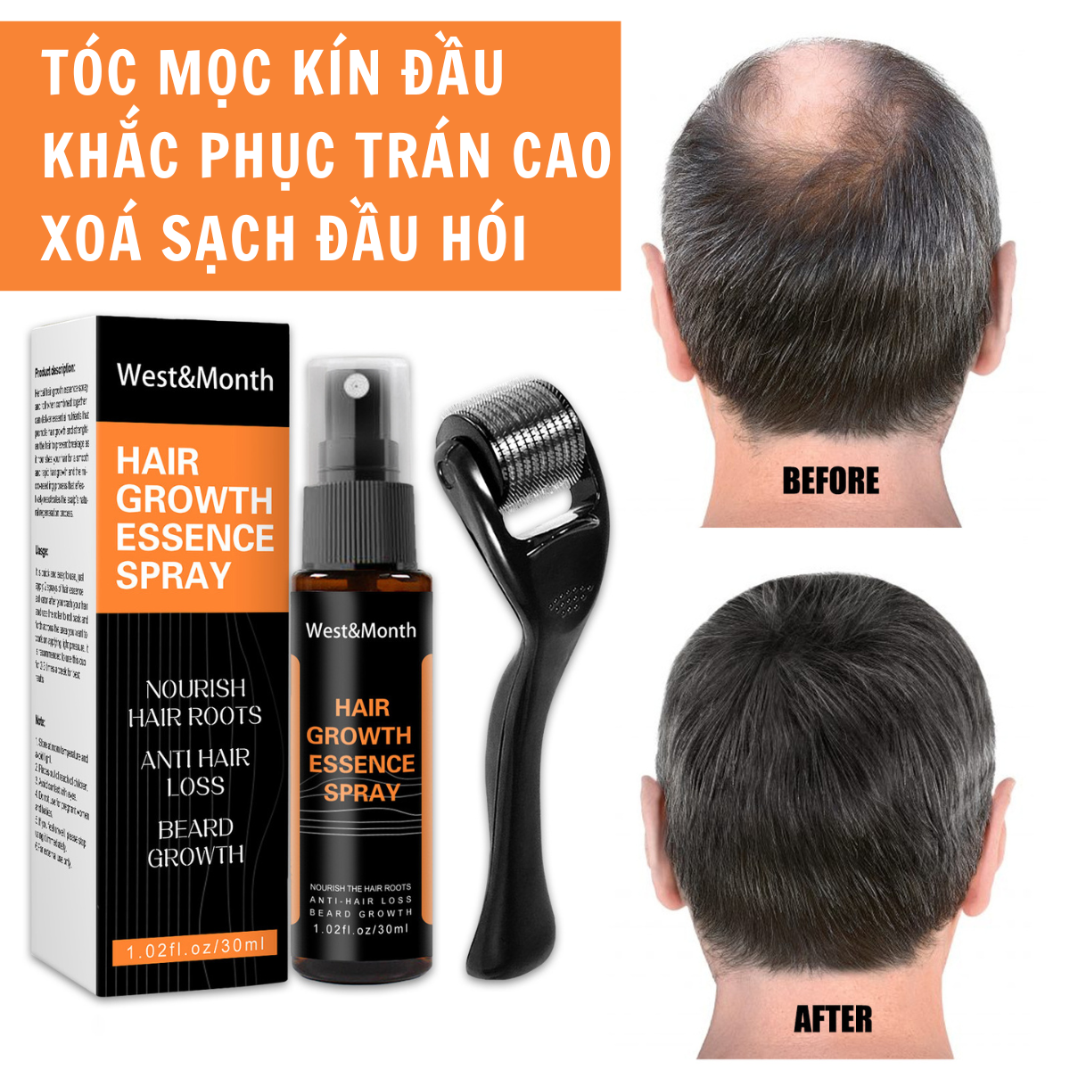 Chai xịt mọc tóc herbal hair growth essence spray chai xịt dưỡng tóc tự nhiên phục hồi hư tổn, giảm gãy rụng và mọc tóc nhanh 30ml