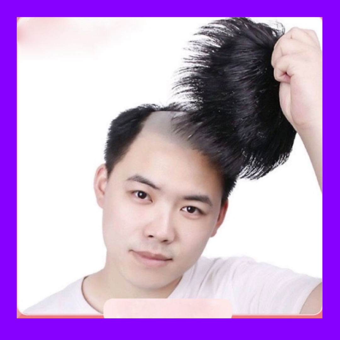 CHE HÓI NAM - Tóc giả nam che hói cho nam cao cấp - TG3111