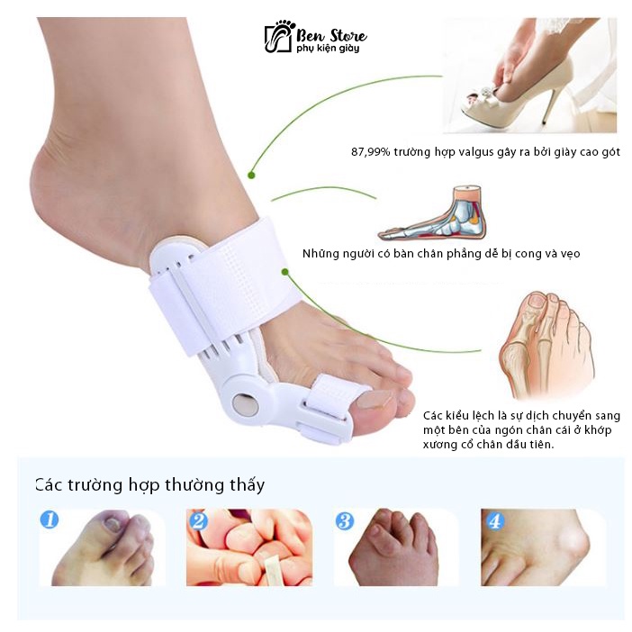 1 Đai nẹp hỗ trợ định hình ngón chân cái phiên bản CAO CẤP, điều chỉnh dễ dàng, tiện dụng
