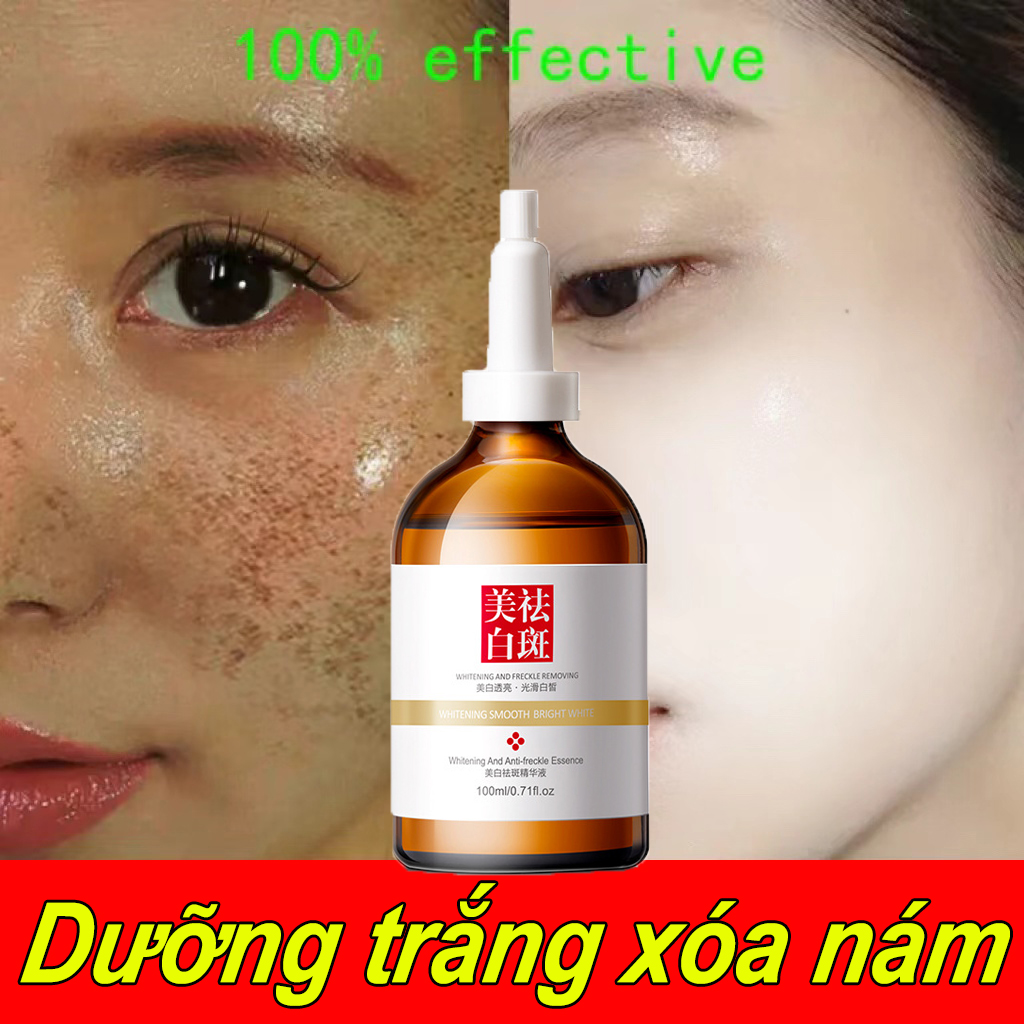 Kem xóa tàn nhang đồi mồi Tinh chất làm trắng sạch tàn nhang 100ml Kem trắng da và xóa tàn nhang Hiệu quả làm mờ thâm nám tàn nhan kem thâm nám tàn nhang đồi mồi Săn chắc da kem dưỡng ẩm cho mặt