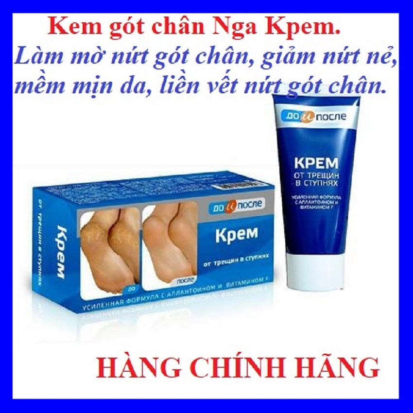 Kem mờ nứt gót chân Kpem Nga 50ml, liền vết nứt, dưỡng da chân, mờ chai sạn