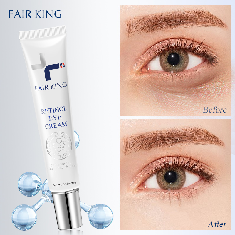 FAIR KING Retinol Eye Cream Chống Nhăn Chống Lão Hóa-Loại Bỏ Quầng Thâm Mắt - Bọng Mắt, Cho Đôi Mắt Tươi Tắn Rạng Rỡ Dùng Cho Mọi Loại Da 15g