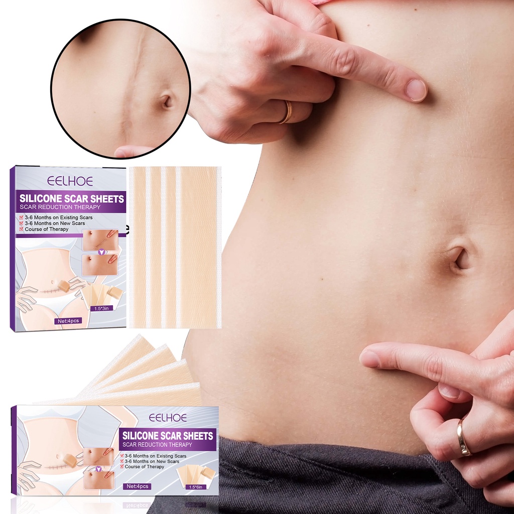 Bộ 4 miếng dán che sẹo lồi sẹo lõm sẹo thâm tiệp màu da