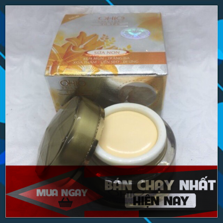 Kem mụn - xoá thâm - liền sẹo ohio 18g