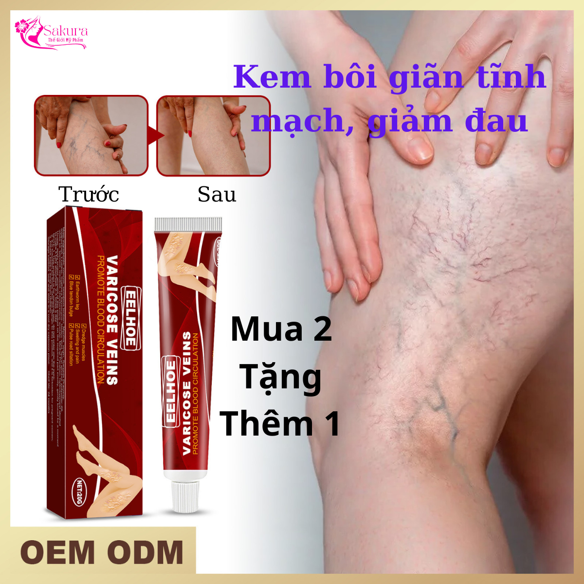 Kem bôi suy giãn tĩnh mạch giúp giảm đau vùng chân cải thiện tuần hoàn máu làm dịu đau chân loại bỏ sưng mạch máu chân phồng gân xanh