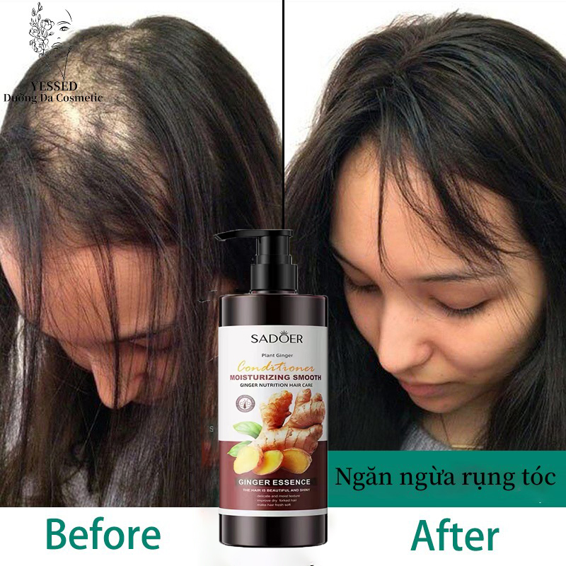 Dầu gội mọc tóc 500 ml tinh dầu mọc tóc dầu gội gừng dầu gội rụng tóc giảm rụng tóc mọc tóc nhanh kích thích mọc tóc