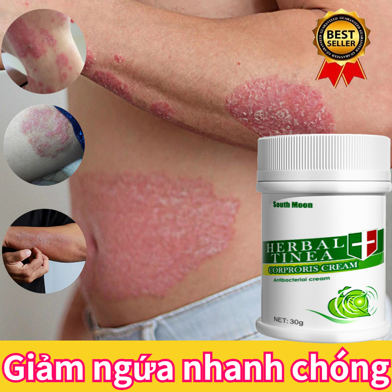 Kem chống ngứa nhanh chóng, ngăn ngừa ngứa vùng kín, kem loại bỏ eczema mẩn ngứa, kem kháng khuẩn, chiết xuất tinh chất thảo mộc, dùng để giảm viêm da và mẩn đỏ, kem loại bỏ mẩn ngứa kem vẩy nến, kem chống ngứa