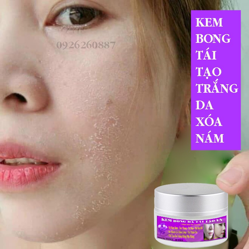 [HCM]Kem VN Bong Da Tái Tạo Trắng Hồng Mờ Sạm Nám Tàn Nhang