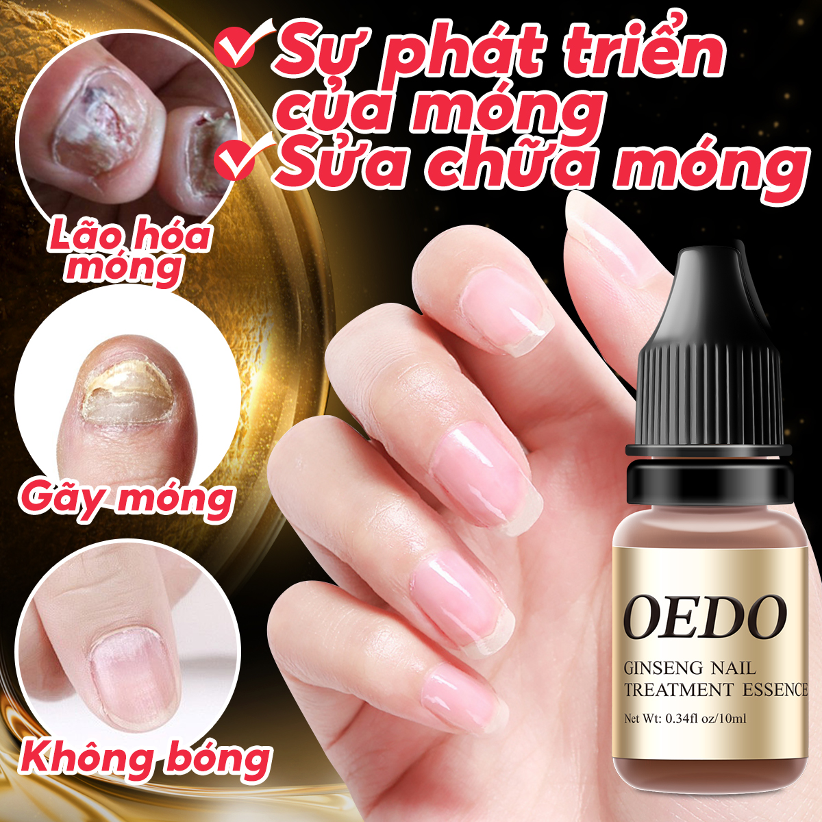 OEDO Tinh dầu chiết xuất thảo dược giảm nấm móng tay chân kháng khuẩn giá siêu tốt - intl