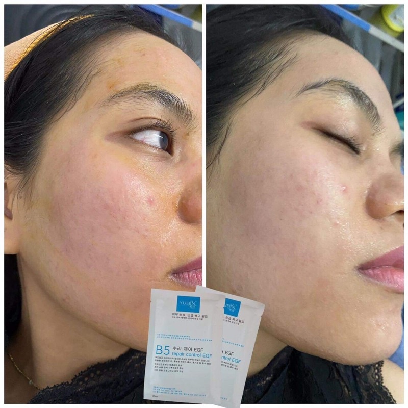 Mặt nạ Yuejin B5 cấp ẩm, phục hồi da