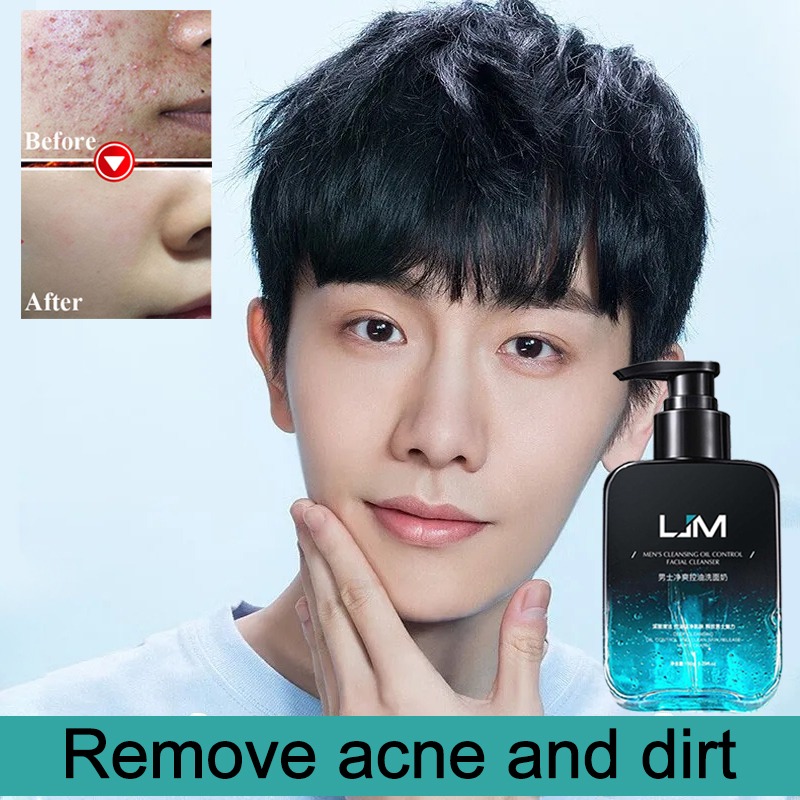 Sữa Rửa Mặt Nam Trắng Da Sạch Dầu Mụn 150g Sữa Rửa Mặt Da Dầu Mụn Cho Nam Nicor