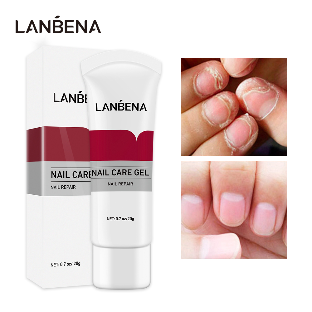 LANBENA Gel sửa chữa móng tay Điều trị nấm móng Loại bỏ nấm móng Dưỡng móng Chăm sóc tay và chân