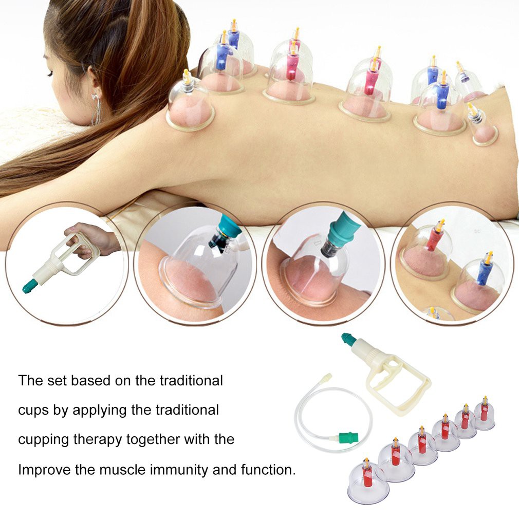 Bộ Giác Hơi 12 Ống Hút Chân Không,không cần dùng lửa, giảm đau vai, cổ lưng, gáy, giải cảm, thích hợp người lớn tuổi, người làm việc nặng