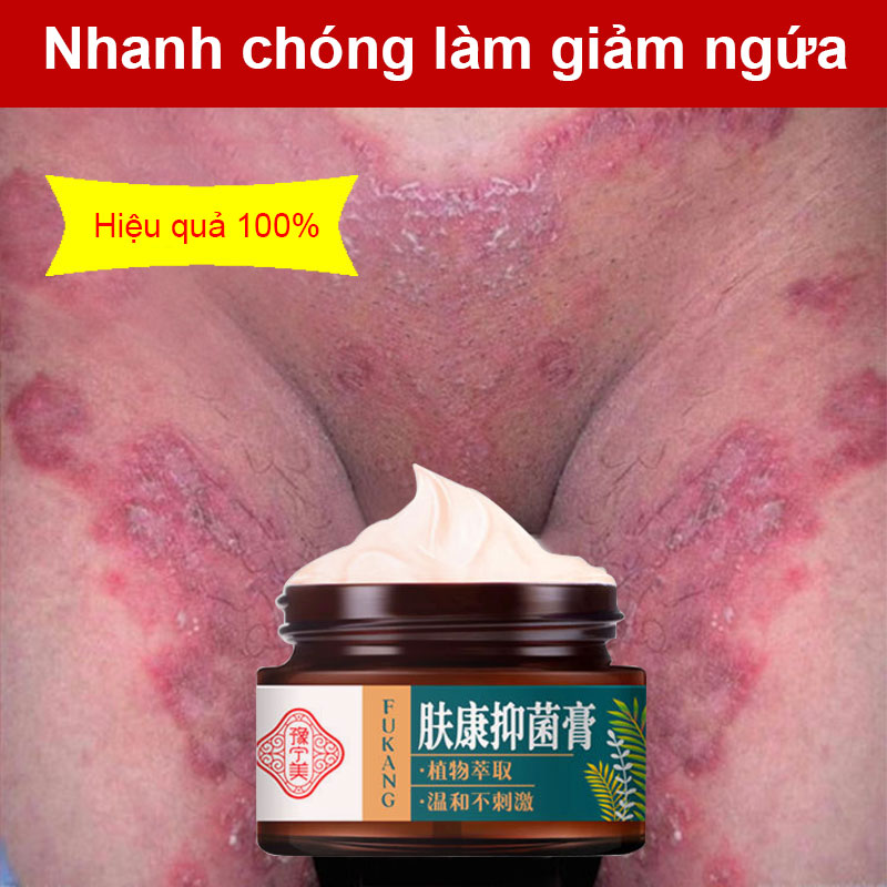 【Mua 1 tặng 1】Kem thảo dược, Kem chống ngứa, Kem chống nấm cho bệnh nấm, ngứa, hắc lào, bệnh vẩy nến, dị ứng, Miễn phí vận chuyển