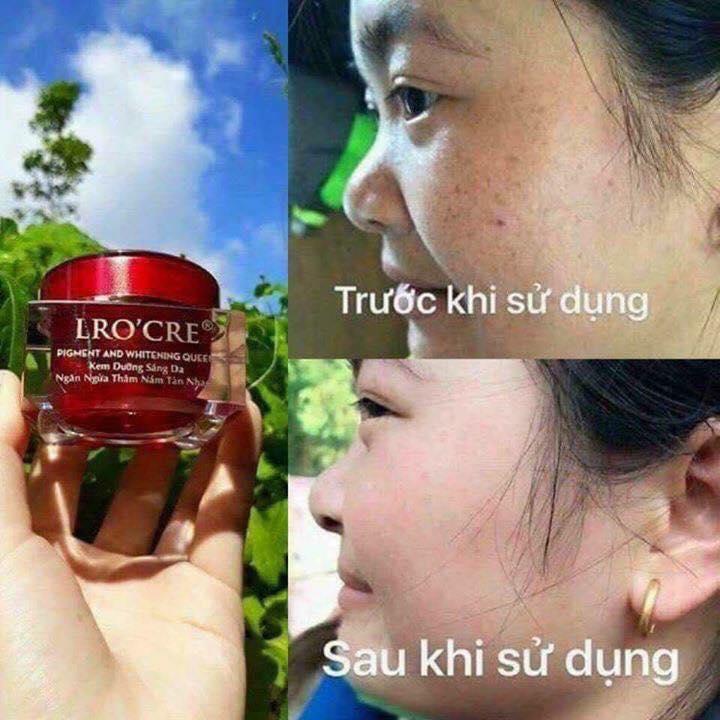 Kem mờ Nám Tàn Nhang Dưỡng Trắng Ban đêm LRO'CRE