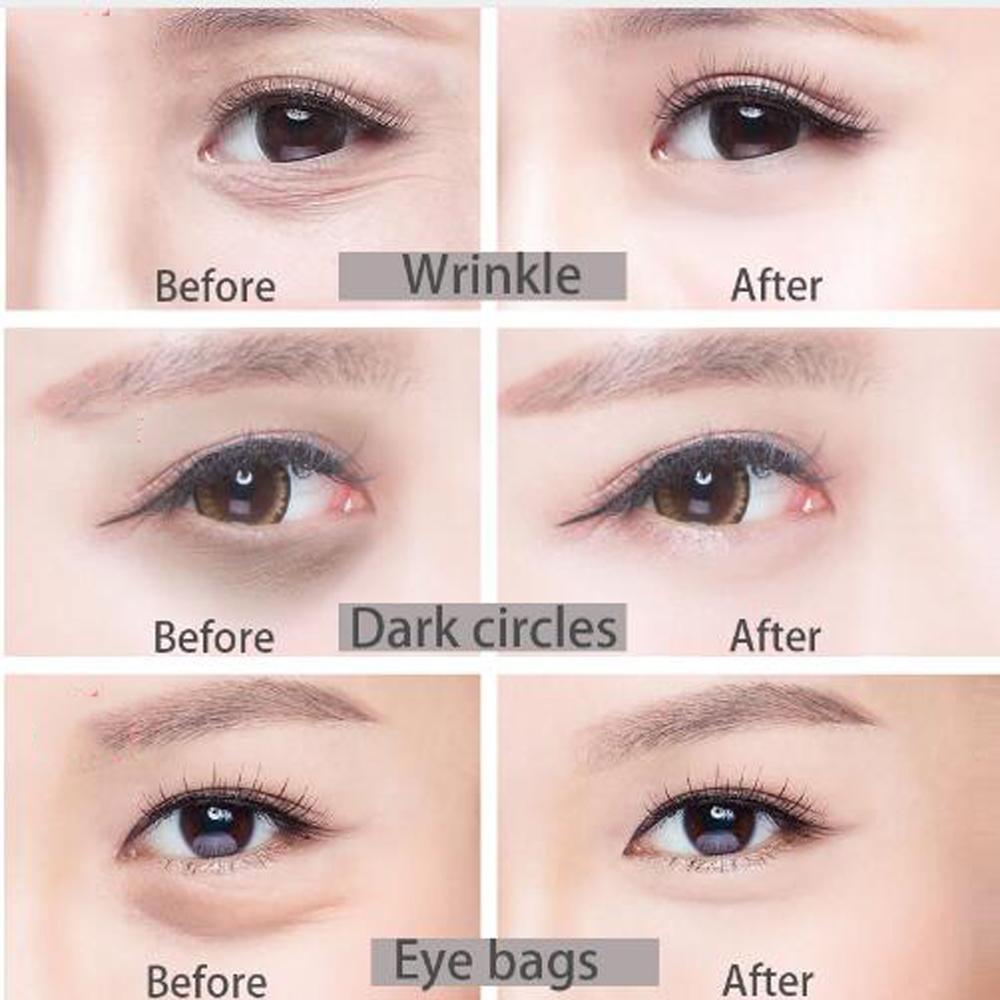 [HCM]KEM DƯỠNG MẮT LILIA WRINKLE EYE CREAM Chống nhăn lão hóa oại bỏ quầng thâm bọngdưỡng ẩm
