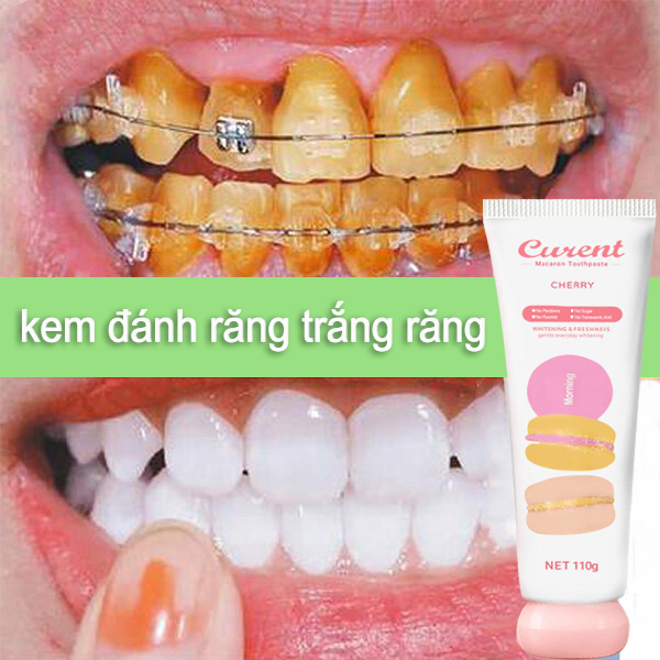 Kem đánh răng dạng bọt baking soda làm sạch sâu mảng bám loại bỏ vết bẩn màu vàng loại bỏ hơi thở thơm mát loại bỏ mùi răng miệng kem làm trắng răng kem đánh răng dụng cụ chăm sóc răng miệng 100gmảng bám răng, cao răng,